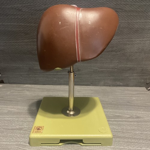 Somso liver adjustable - liver, on