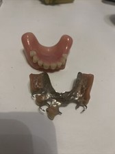 lot de 2 dentier fausse dent curiosité dentition bridge 