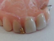 DENTIER avec Or prothèse