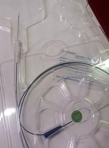 Tipless nitinol dormia - tipless, stone