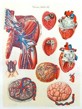 Lithographie Table Anatomique