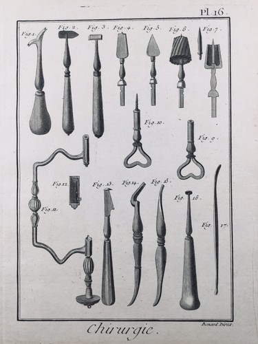 Chirurgie 1779 trépan - chirurgie,