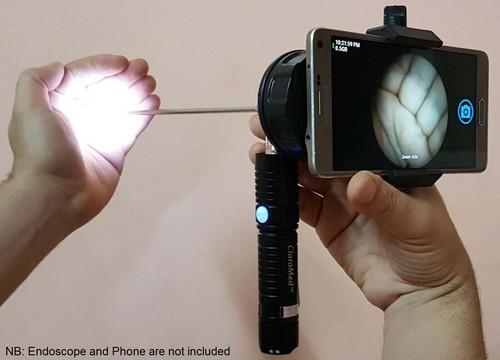 Adaptateur endoscope pour - adaptateur, d'endoscope
