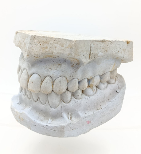 Vintage dental plaster cast - vintage,