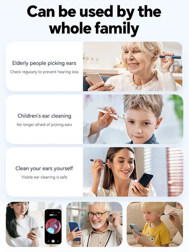 Otoscope intelligent caméra - otoscope,