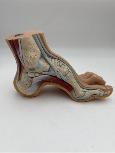 Somso ns3 high arched - arched, foot