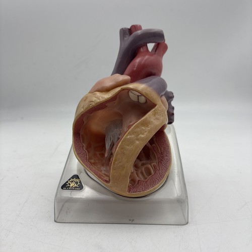 Somso heart anatomical - os, 7/4