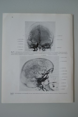 Planche anatomie humaine - planche,