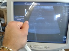 GE i12L Intraoperative