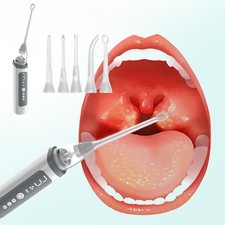 1Set Vacuum Tonsil Stone