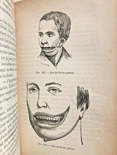 PRECIS de TERATOLOGIE L