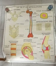 Tableau de science Rossignol: os, articulations, accidents