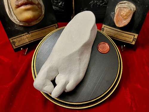 Rare moulage pied plâtre - moulage,