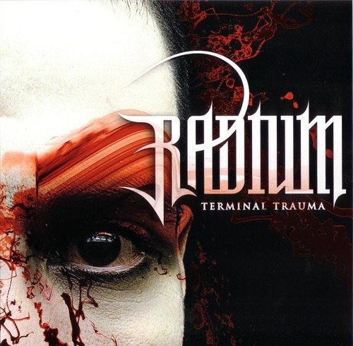 Radium terminal trauma - terminal,
