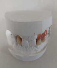Dentier Moulage Plâtre