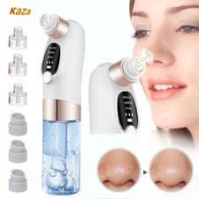Aspirateur électrique pour points noirs, nettoyeur de visage, élimination, quali