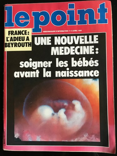 Point 1986 une - point, 7/04/1986;
