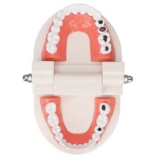 Maladie Dentaire Caries Dents