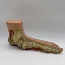 Somso NS2 Flat Foot - Distal