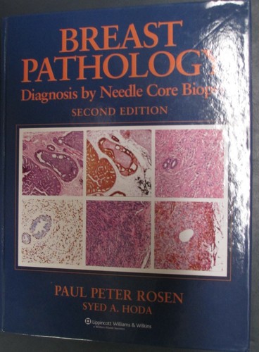 Breast pathology diagnosis - breast, by