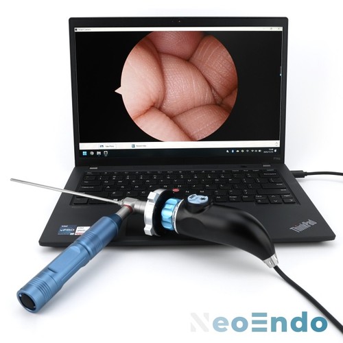 Portable medical usb endoscope - portable,