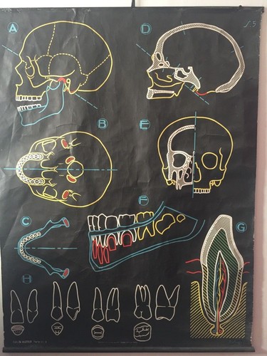 Sérigraphie pédagogique - , dr