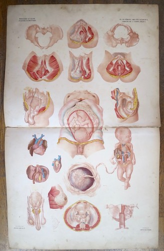 Lithographie périnée - lithographie,,