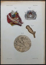 1866 - Prostate, conduits éjaculateurs - Anatomie & Urologie - Gravure ancienne