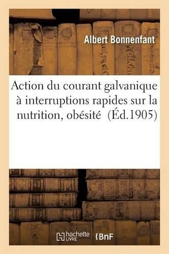 Albert bonnenfa action - bonnenfa, du
