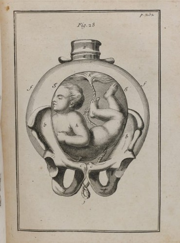 Medecine livres anciens - [medecine], anciens]