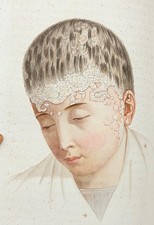 Cazenave traité des - traitÉ,