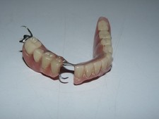 Ancien dentier prothèse