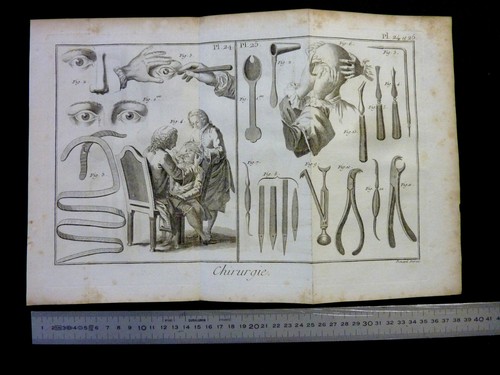 1779 gravure chirurgie - 1779,