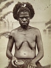 photo CDV Allan Hughan Nouméa - indigène du Pacifique, femme, seins nus, ca 1875