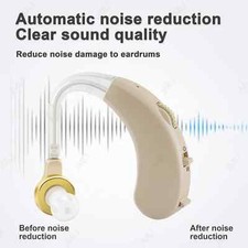 1PCS Appareil Auditif Mal