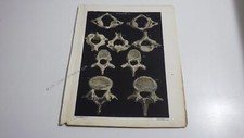 1850.lithographie couleur