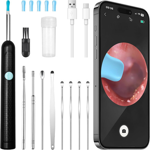 otoscope