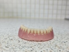 Prothèse inférieure