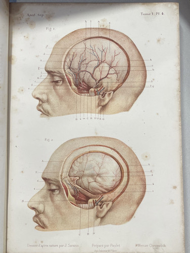 Anatomie écorché gravure - anatomie, écorché,gravure