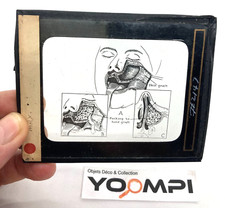 objet ancien lot 13 diapos médical déco dentiste cabinet de curiosité photo