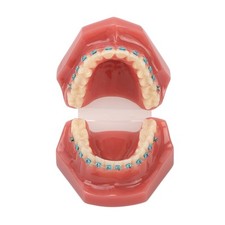 Modèle D'orthodontie Dentaire