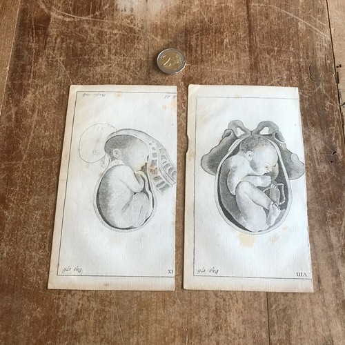 Ancienne gravure anatomie - anatomie, n109