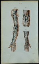1852 - Planche anatomie Angéiologie : Veines du bras - Médecine
