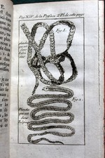 ANDRY DE BOISREGARD : De la génération des vers dans le corps de l'homme 1741