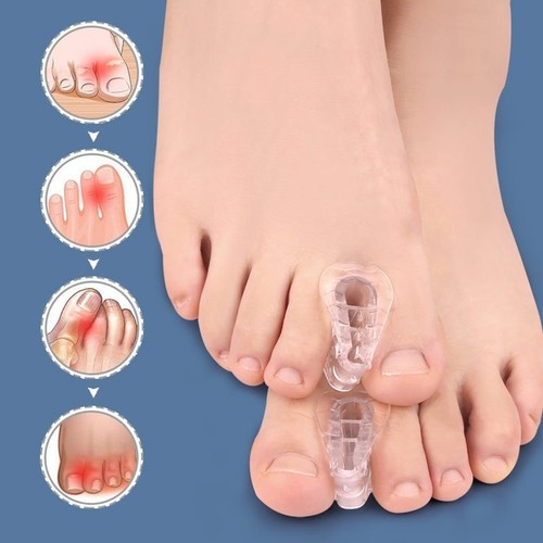 chaussures acupuncture