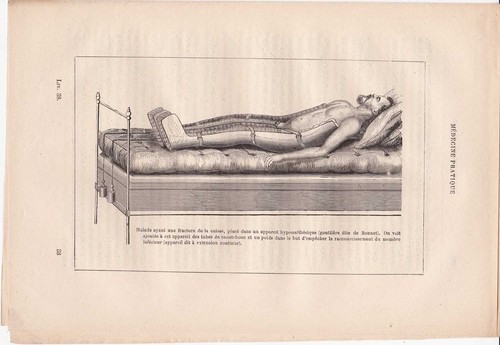 Ancienne gravure médicale - , 38-