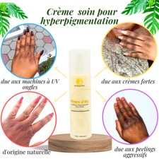 Crème SOIN  Effaceur d'hyperpigmentation pour phalanges, pieds