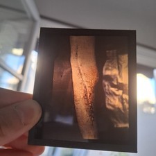 Rare Ensemble Blesses Guerre Operation Gueule Casse Medecin Poilu Ww1 Autochrome