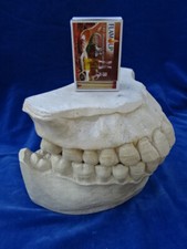 CURIOSITE / Curiosity - CENDRIERS MODELE DENTAIRE / Ashtrays Dental model - TOP