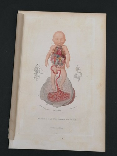 Gravure xixéme siècle - gravure,
